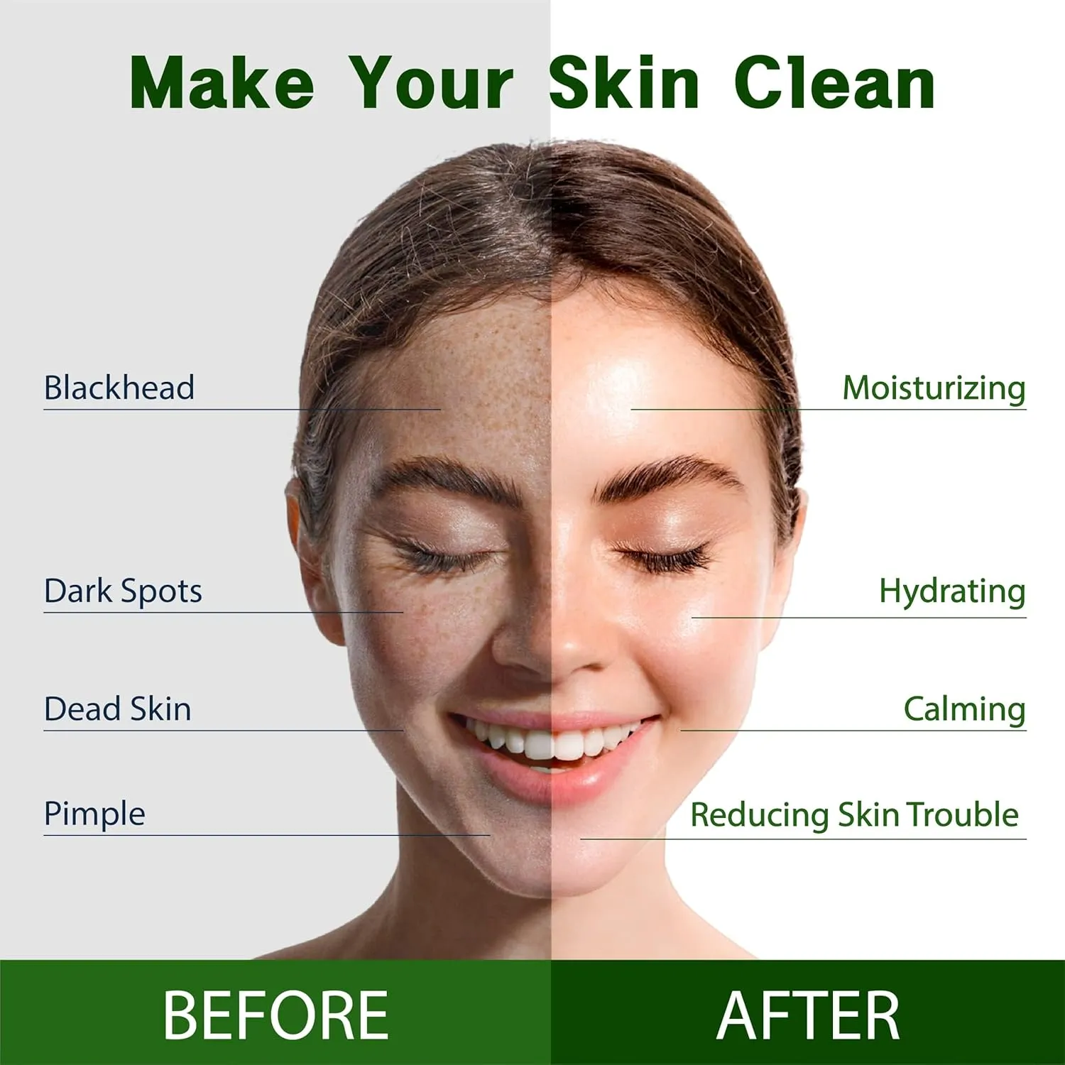 Purederm Vegan Tea Tree Sheet Masks (12 Packs) – Facial Sheet Mask for Calming & Trouble Reducing Treatment